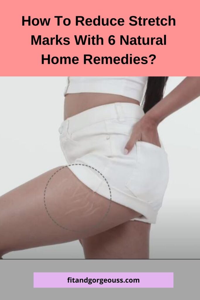 How To Reduce Stretch Marks  With Natural Home Remedies?