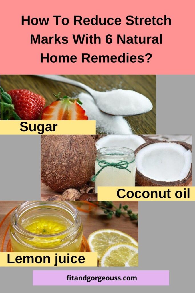How To Reduce Stretch Marks  With Natural Home Remedies?
