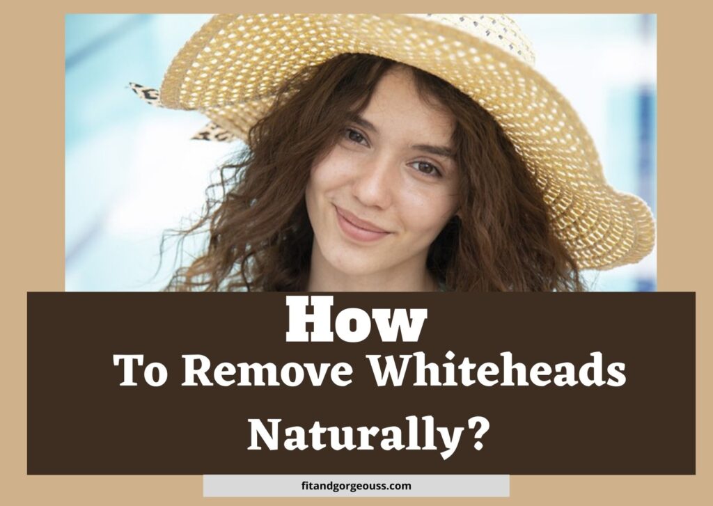How To Remove Whiteheads Naturally?