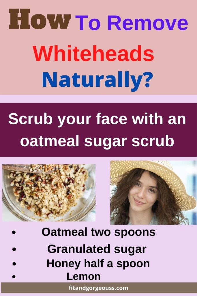 How To Remove Whiteheads Naturally?