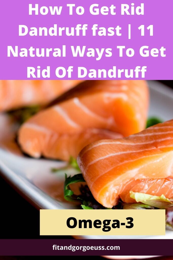 How To Get Rid Dandruff fast | 11 Natural Ways To Get Rid Of Dandruff